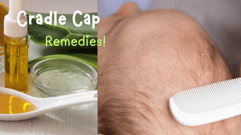 How To Make DIY Natural Remedies for Cradle Cap!