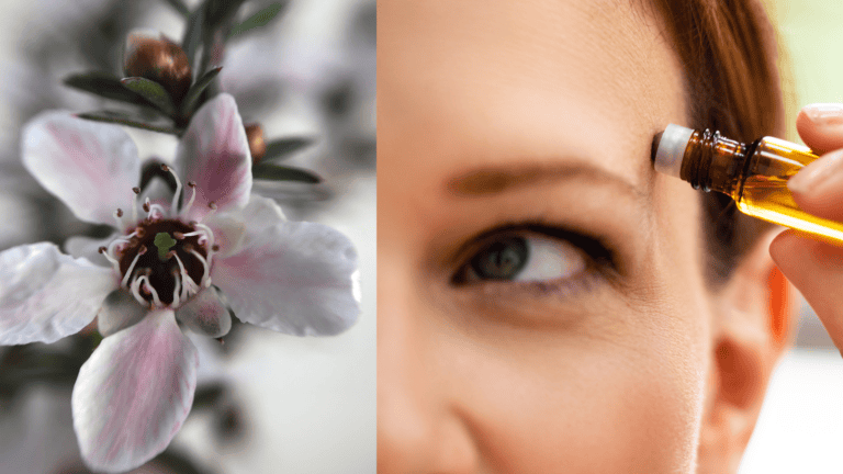 How To Use Manuka Essential Oil for Sensitive Skin!